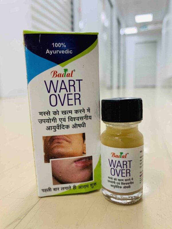 BADAL WART OVER - Image 2